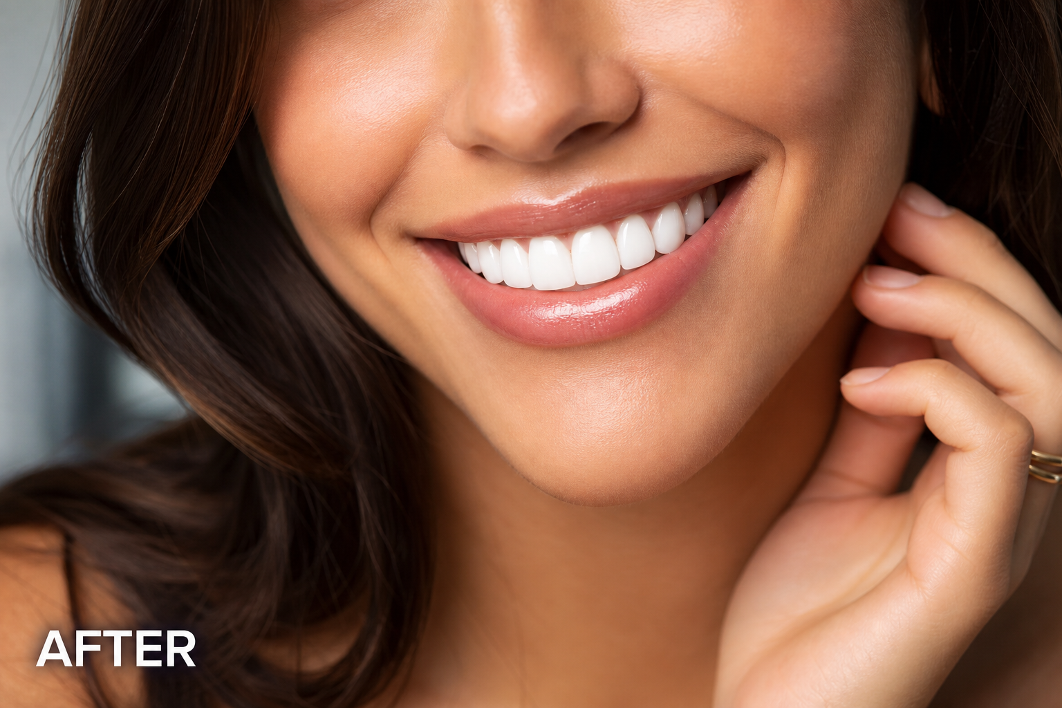 Hollywood Smile